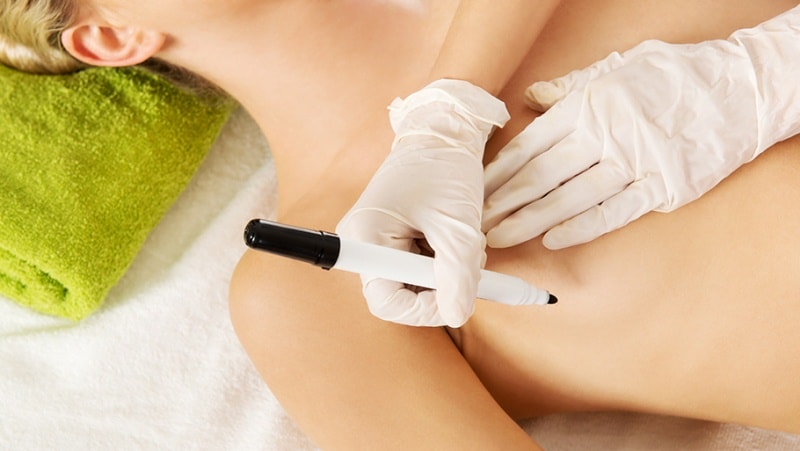 Разметка на груди