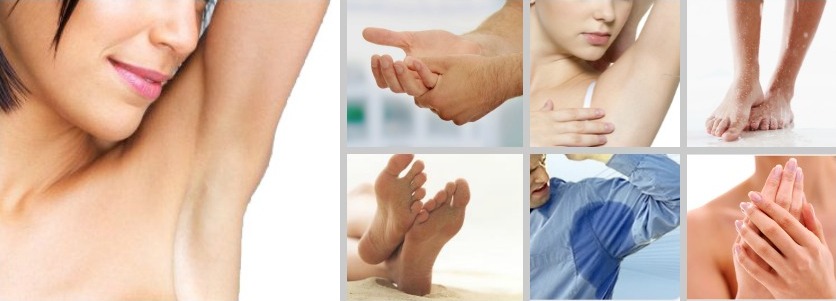 Что такое гипергидроз и как его лечить