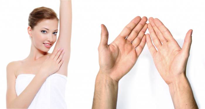 Что такое гипергидроз и как его лечить