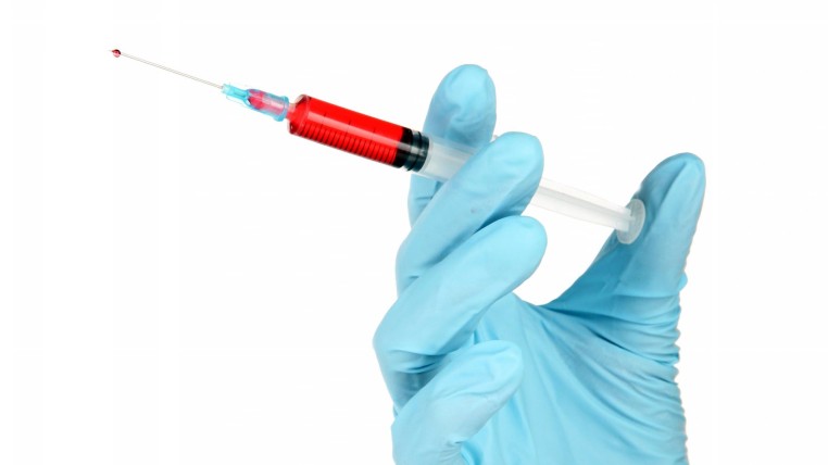 укол для плазмолифтинга