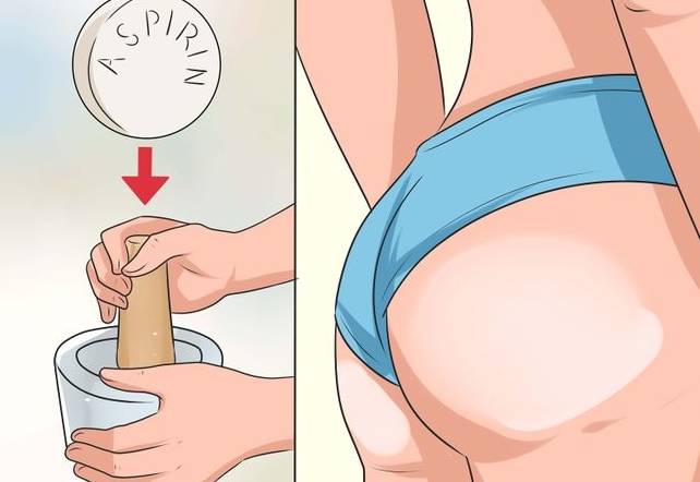 как убрать прыщи на попе