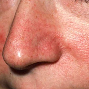 kak-vyglyadit-kuperoz