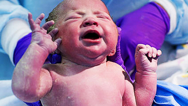 kakie-prichiny-shelushenie-kozhi-u-novorozhdennogo-na-tele-foto