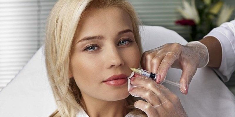 Вводится Ювидерм-4 в носогубную складку