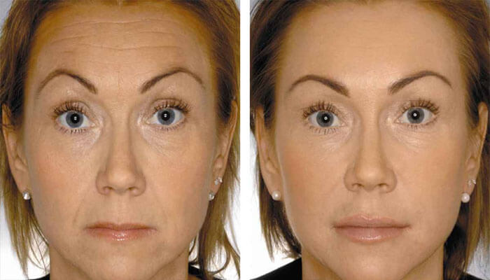 фото до и после женщина