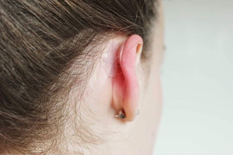 Корректоры для ушей