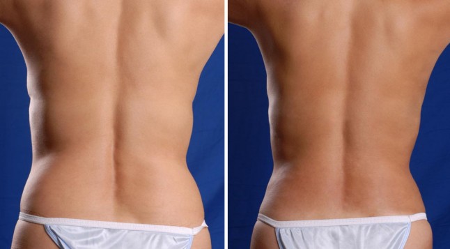 более полная и стройная фигуры