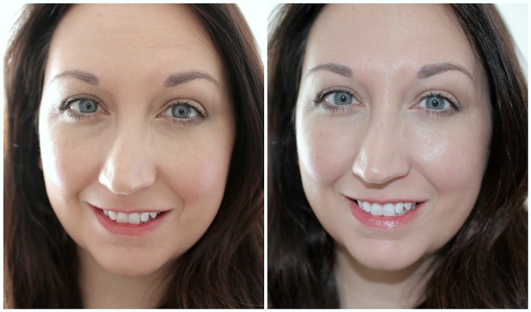 Фото до и после Солгар гиалуроновая кислота