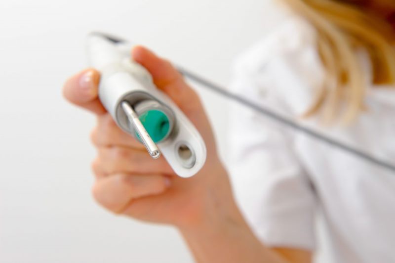 Лазерное удаление кондилом