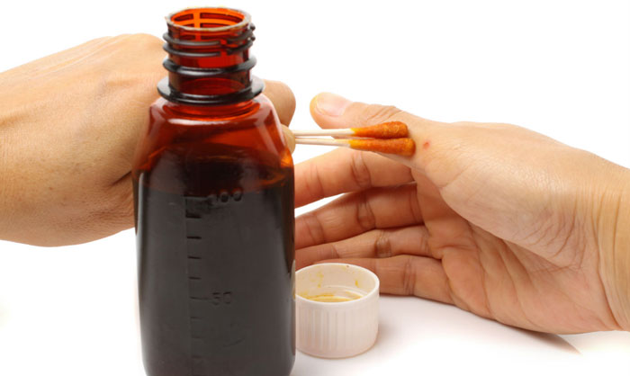 gribok__lechenie_jodom