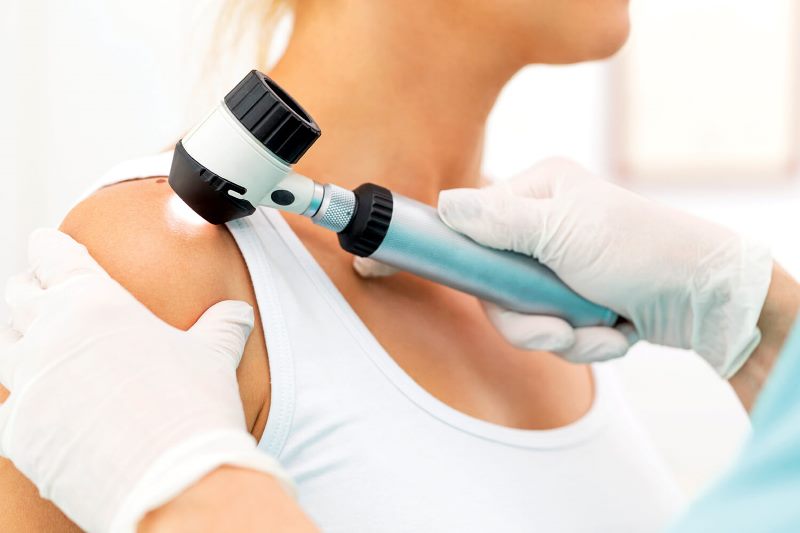 Диагностика гемангиомы