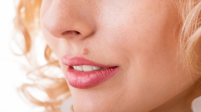 пигментный невус над губой