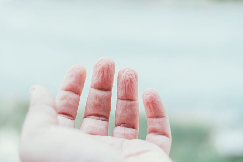 Матерация кожи на руках