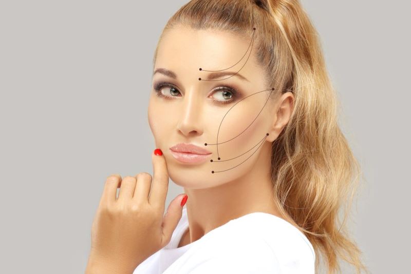 Нитевой лифтинг