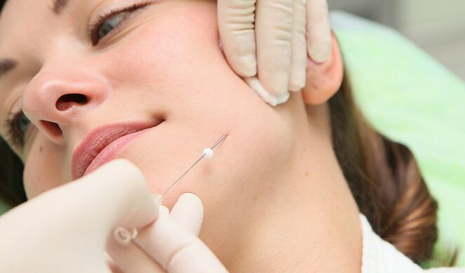 девушке колят иглой в щеку