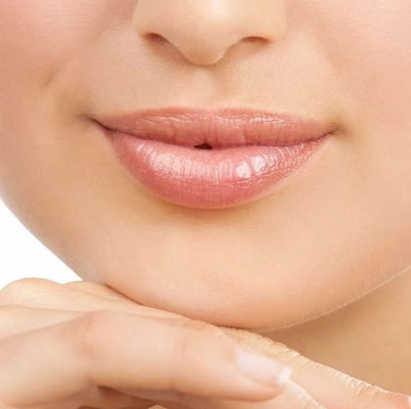 Верхняя губа после элос-эпиляции