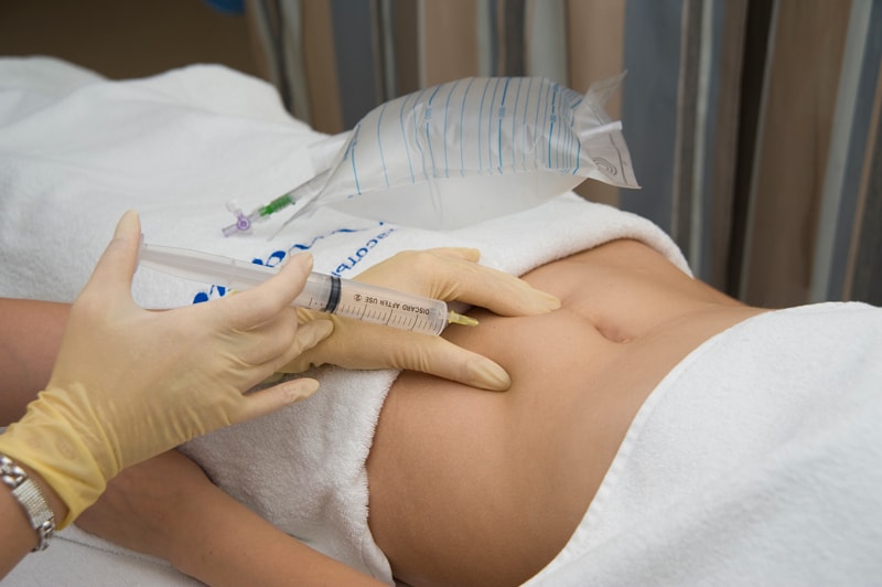 Проводится озонотерапия для похудения