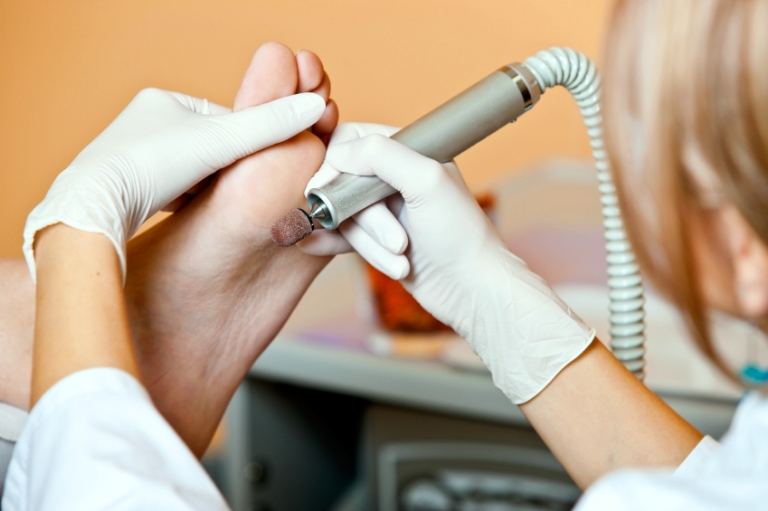 Аппаратный педикюр