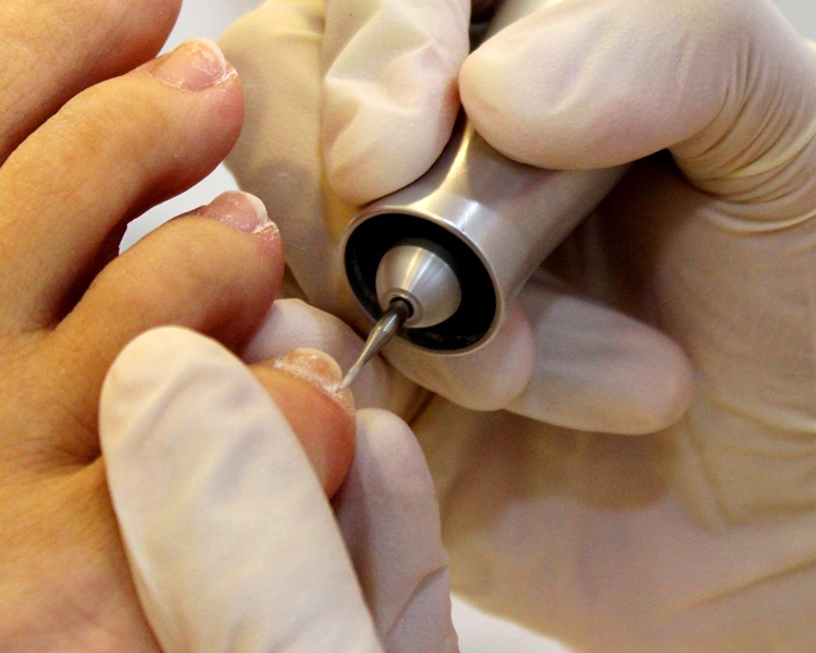 аппаратный педикюр возле ногтей