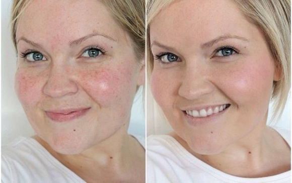 фото до и после