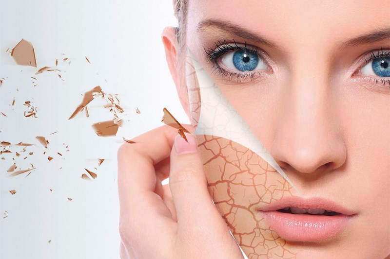 Пилинг лица