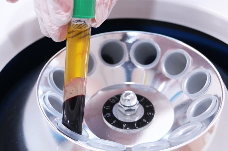 Пробирки для плазмолифтинга