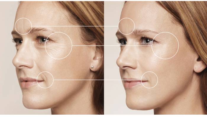 до и после девушка