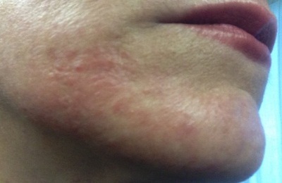 пример на бороде