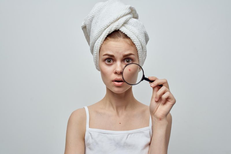 Проблемная кожа