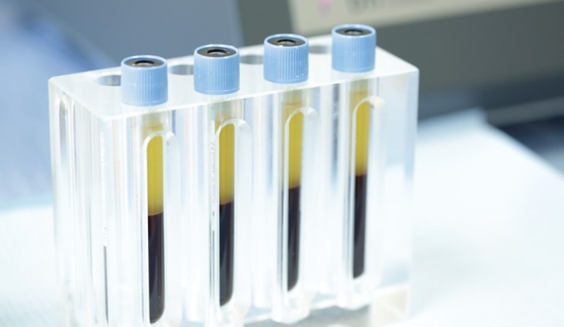 Пробирки для плазмолифтинга