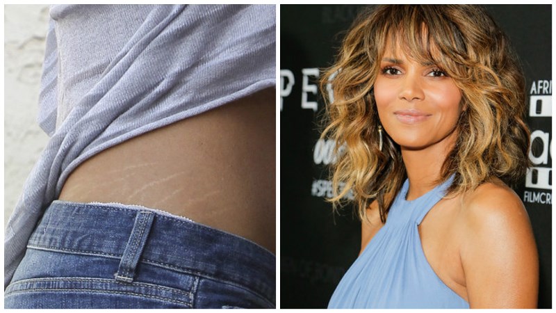 Холли Берри и растяжки на теле