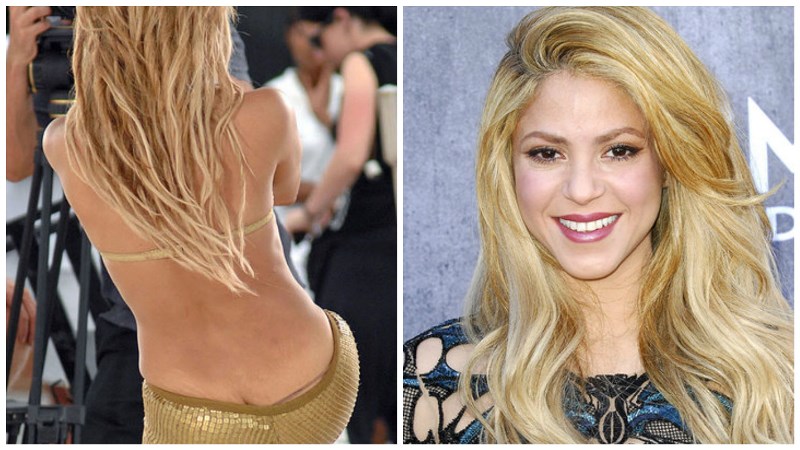 Шакира и растяжки на теле