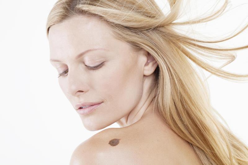 Родинка на плече