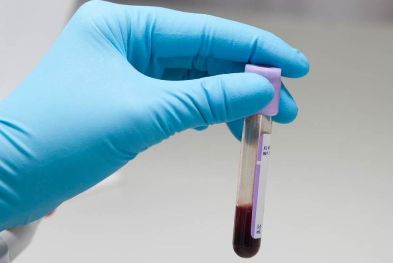 Доктор держит пробирку для плазмолифтинга