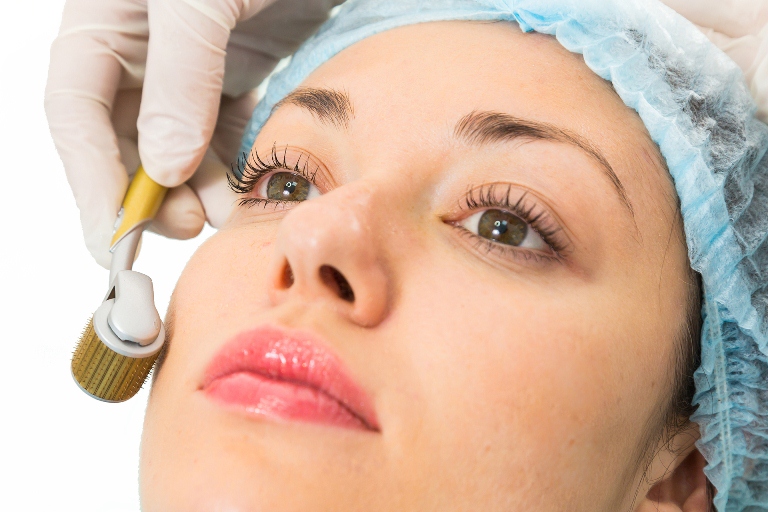 Применение мезороллера для лица