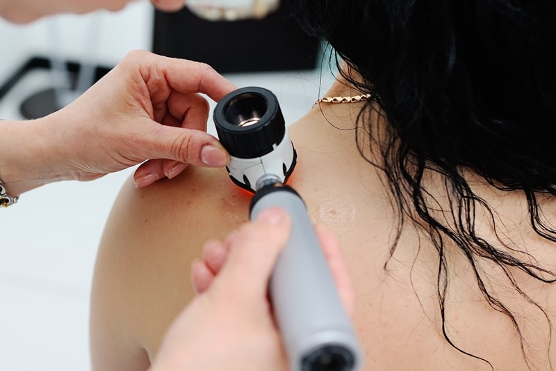 Диагностика родинки