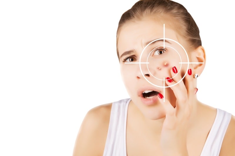 Закрытые комедоны на лице