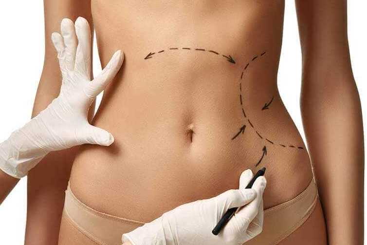 Пластика тела