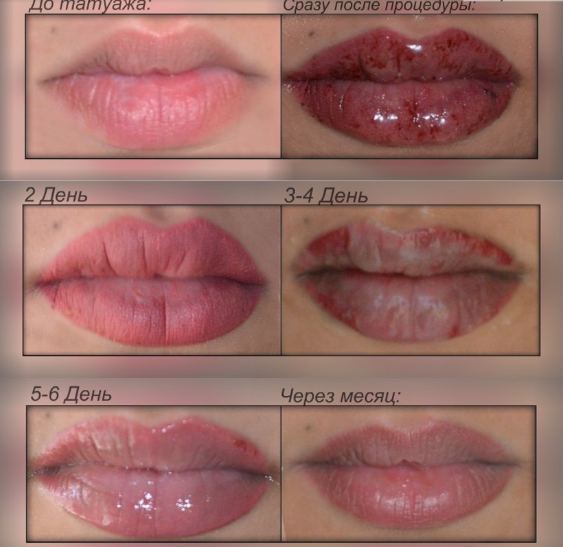 Заживление после перманентного макияжа губ