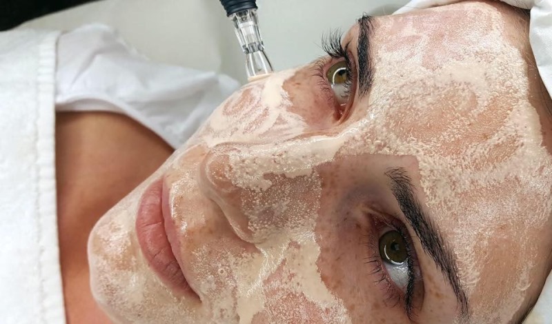 Проводится процедура BB glow