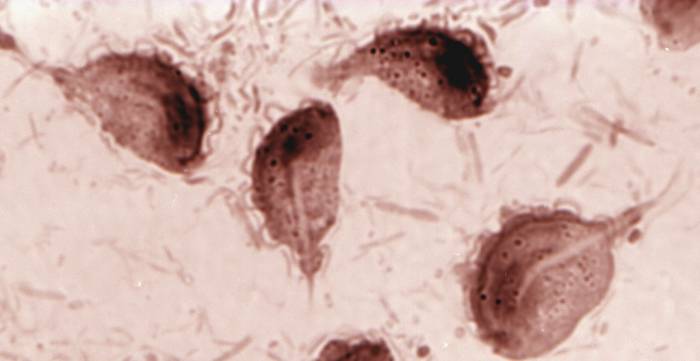 трихомоноз фото