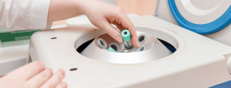 Центрифуга для плазмолифтинга в гинекологии