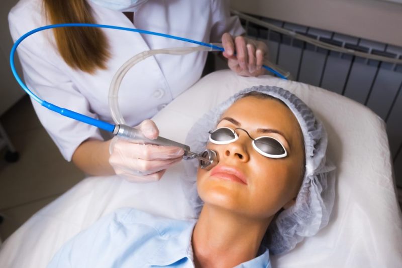 Удаляются капилляры на лице лазером