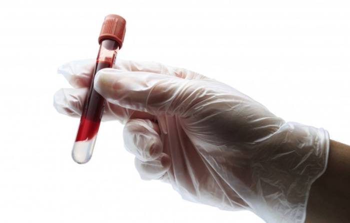 Пробирка в руке доктора