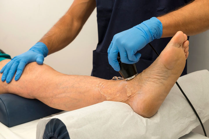 узи вен нижних конечностей