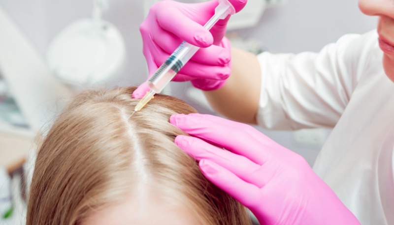 Проводится биоревитализация волос