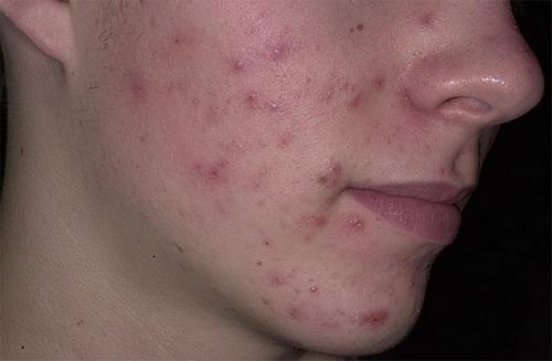 vulgarnye-ugri-chto-eto-takoe